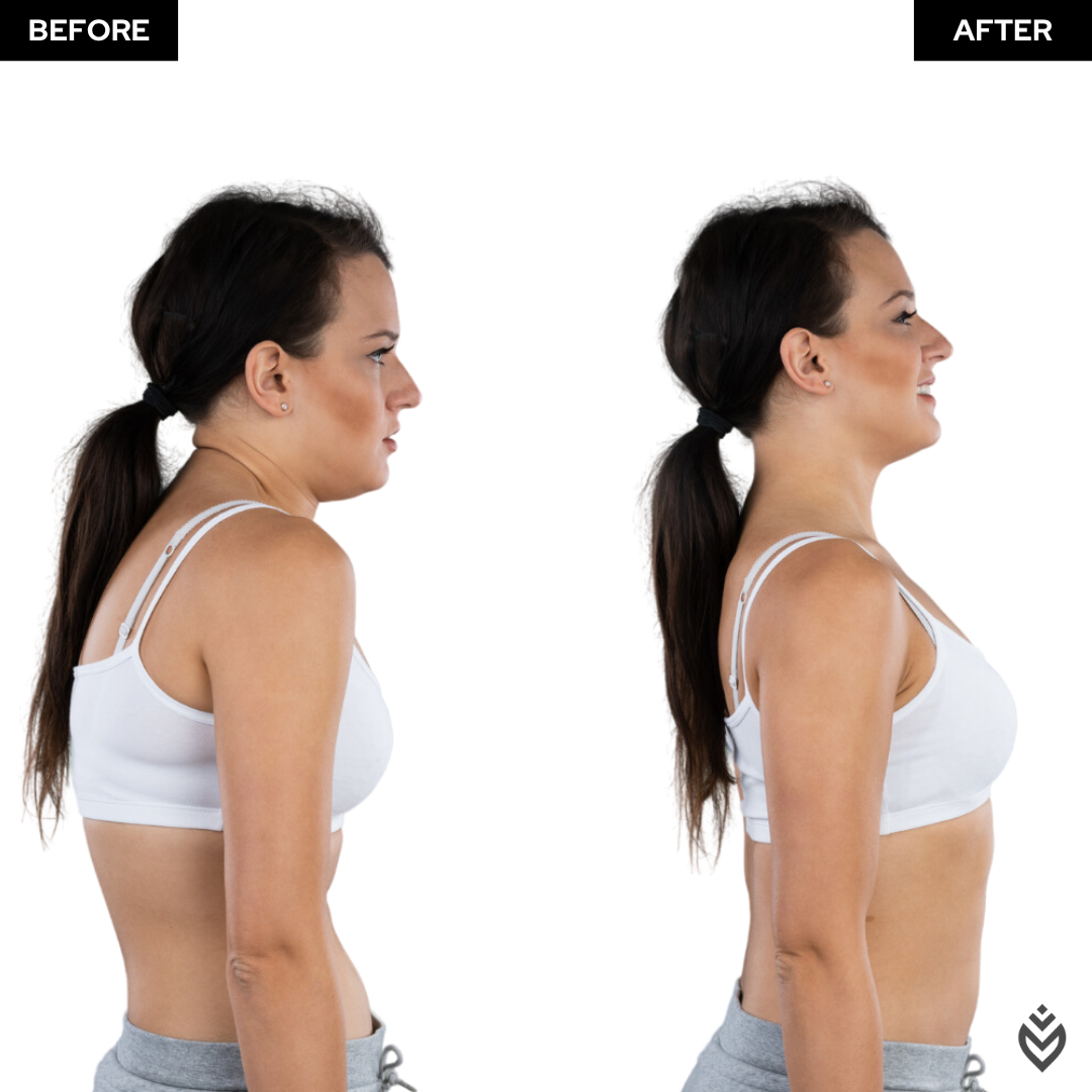 Alturo™ Posture Support Brace